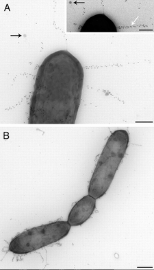 pili microbewiki immunogold microscopy rhamnosus