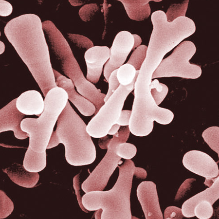 The Role Of Bifidobacterium On The Immune System Microbewiki