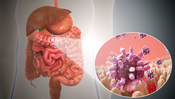 Campylobacter Ureolyticus Microbewiki