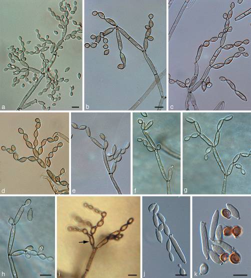 Cladosporium sphaerospermum - microbewiki