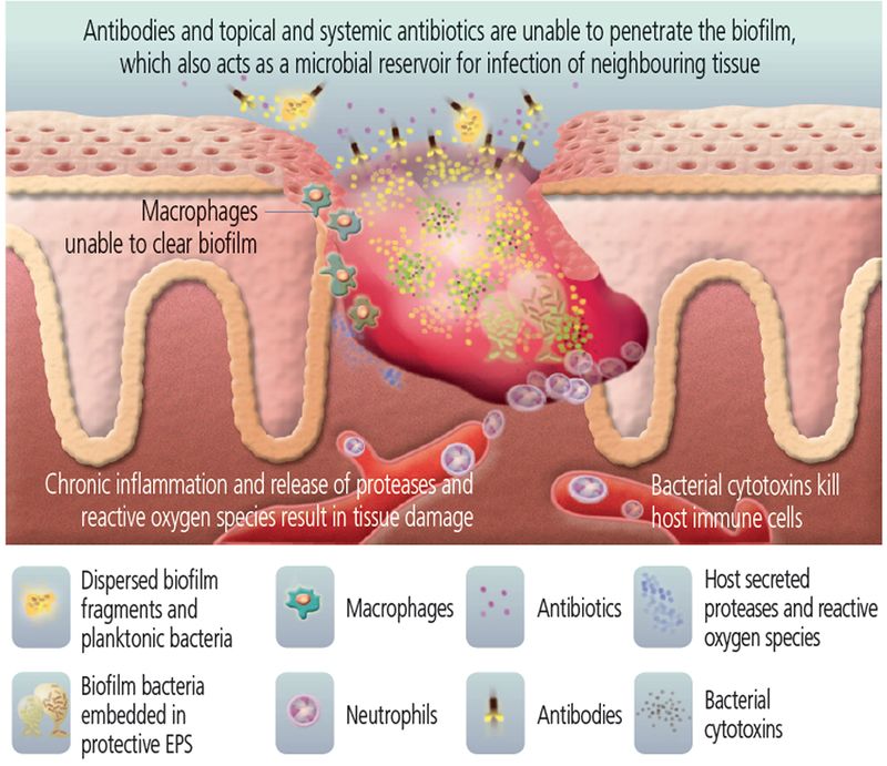 wound-assessment-chronic-wounds-tissue-types-and-infe-vrogue-co