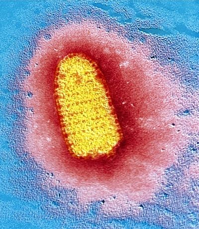 Rabies - microbewiki