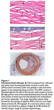 Foam cells.jpg