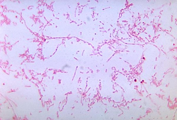 Lemierre's Syndrome - microbewiki