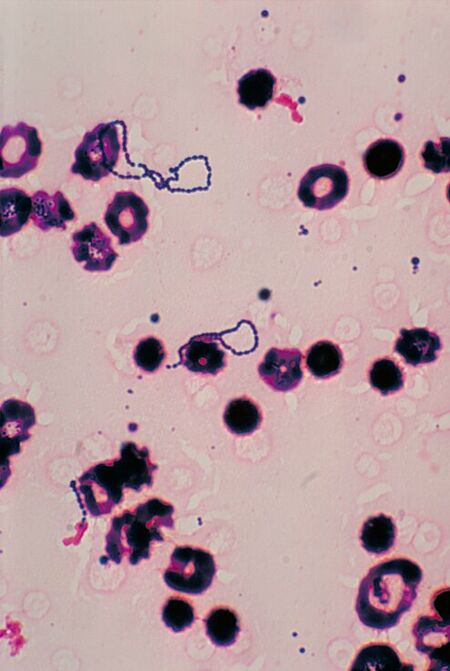 streptococcus-viridans-microbewiki