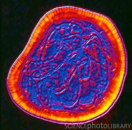 Rubivirus - microbewiki