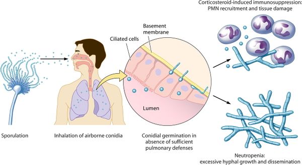 Aspergillus Fumigatus And Aspergillosis Microbewiki