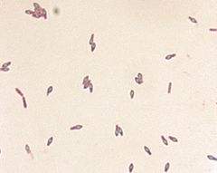 Foodborne Botulism - microbewiki