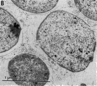 Methanolobus oregonensis - microbewiki