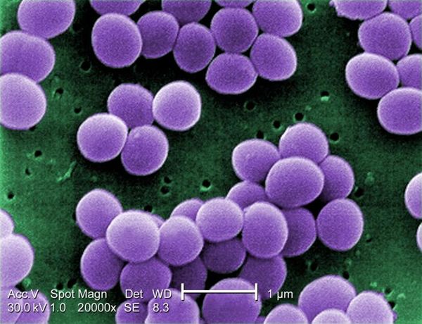 Quorum Sensing in Staphylococcus aureus Infections - microbewiki