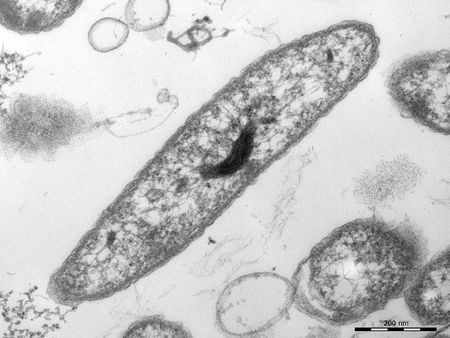 Limnohabitans (genus) - microbewiki