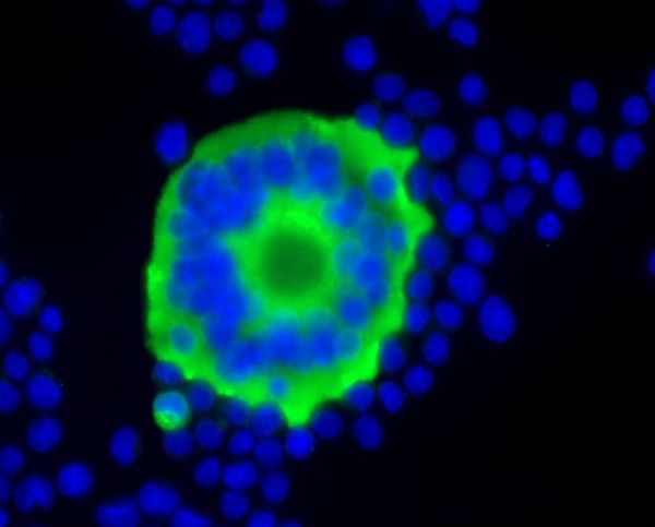 Simian foamy virus - microbewiki