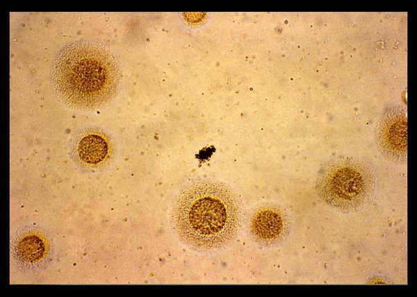 Mycoplasma hominis - microbewiki