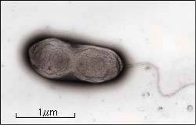 Pseudomonas Putida Alesha Gwen Microbewiki