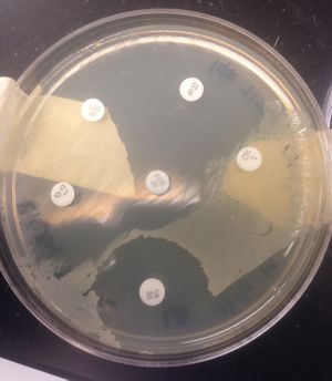 Arthrobacter Oxydans - Microbewiki