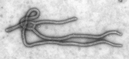 ebola giant microbe