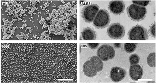 Finegoldia magna - microbewiki