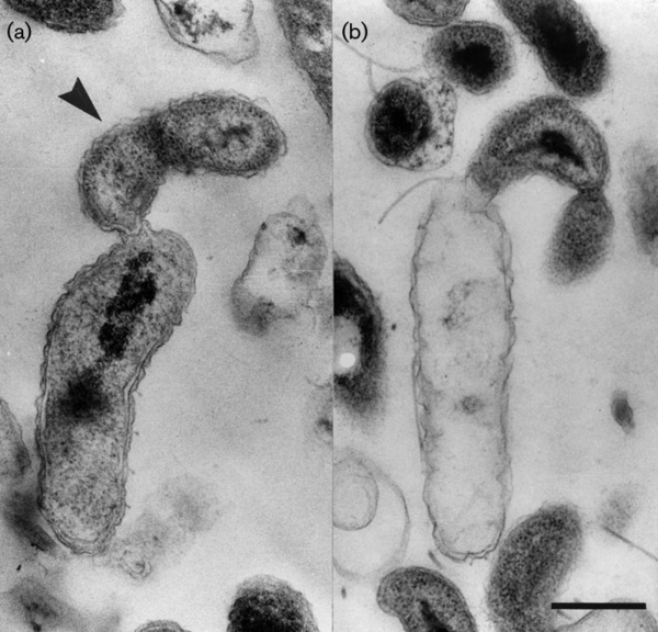 Bdellovibrio exovorus - microbewiki