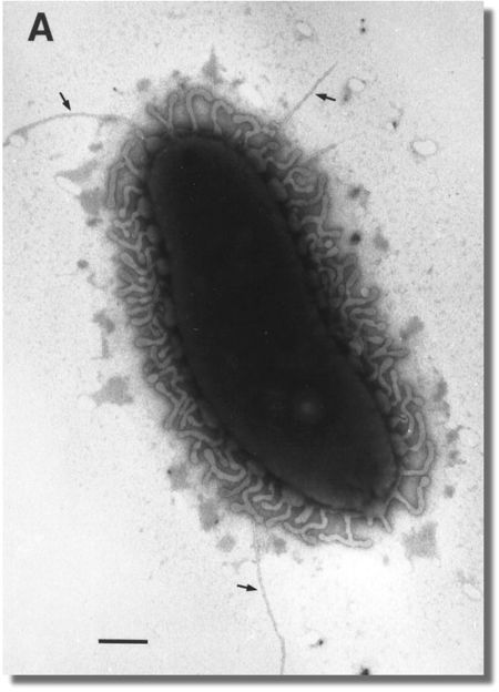 Vibrio vulnificus - microbewiki