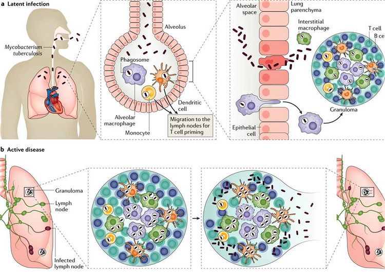 Mycobacterium tuberculosis review - microbewiki